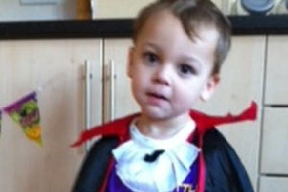 إزالة ورم خطير ونادر من دماغ طفل سبب التواء رقبته