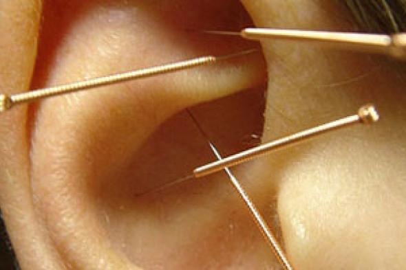 الوخز بالإبر الصينية يساعد فى علاج سرطان الثدى