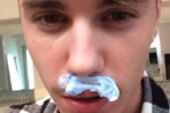 بالفيديو: جستين بيبر يتخلص من "شنب إعدادي"