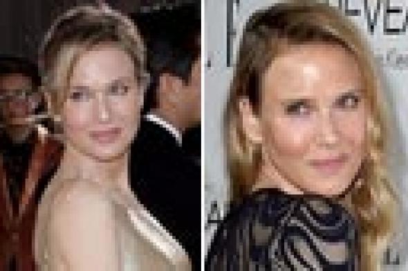 رينيه زيلويجر عن شكلها الجديد: أبدو أسعد وأكثر صحة