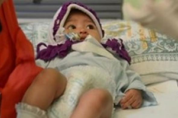 «الختان» يصيب فتيات أوروبا ونساء أمريكا.. بريطانيا تحارب الظاهرة «إلكترونيا».. والاتحاد يكافحها بـ 4 ملايين يورو