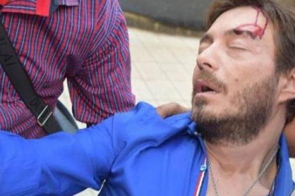 بالصور- أحمد زاهر يرد على تعرضه لحادث سيارة