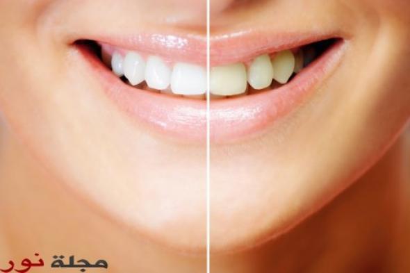 وصفة بسيطة لحماية أسنانك من الإصفرار.. تعرف إليها