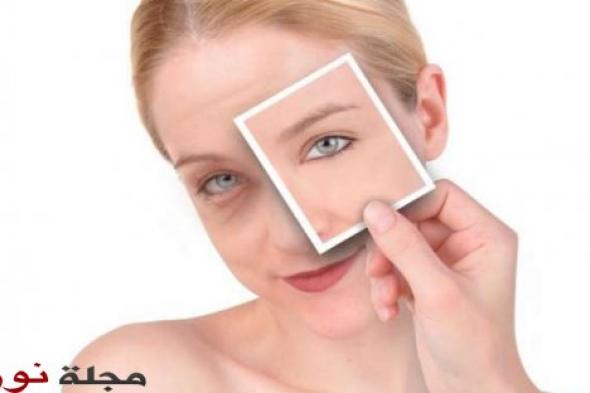 6 طرق طبيعية سهلة لعلاج هالات العين السوداء