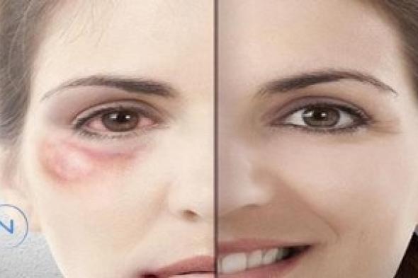 كلفة العنف ضد المرأة بلايين ضائعة ... ونساء يكرهن حياتهن