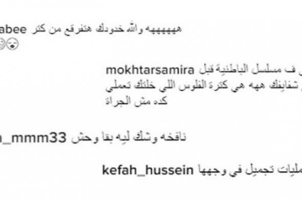 صورة- جمهور غادة عبد الرازق يوجه لها سؤلا بسبب وجها المنتفخ