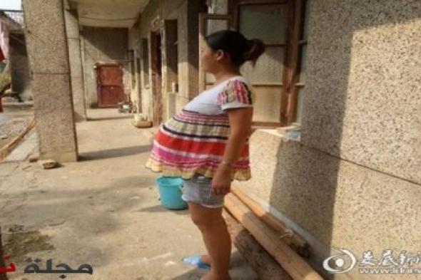 حالة نادرة.. حملت 17 شهراً والنتيجة ؟