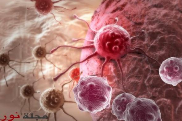 مفاجأة صحيّة مذهلة: فاكهة بكلّ بيت تقتل السرطان.. تناولوها