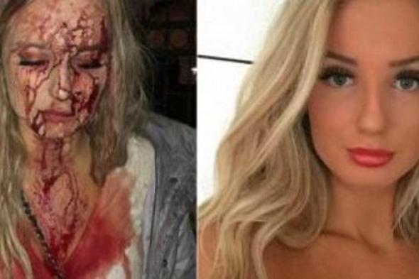 صور مروعة.. رفضت التحرش فهشم وجهها الفاتن وأدماه
