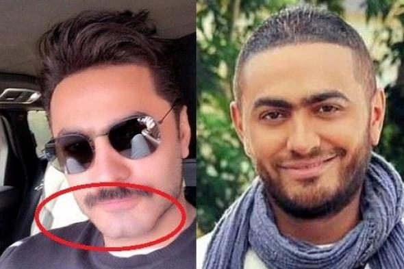 تغيير جذري بوجه تامر حسني.. هل خضع لعملية تجميل؟