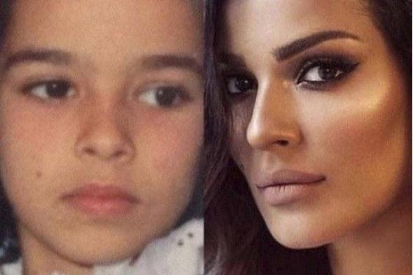 بالصورة: شامة نادين نجيم طبيعية أم تجميل؟ إليكم الجواب