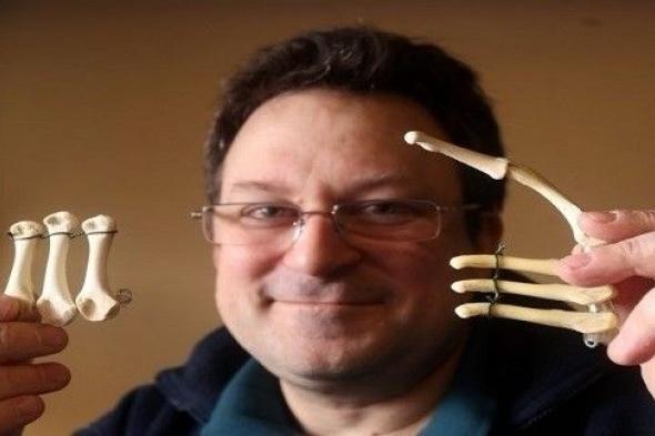 جراح يستخدم عظام الدجاج المشوي في عملياته التجميلية!