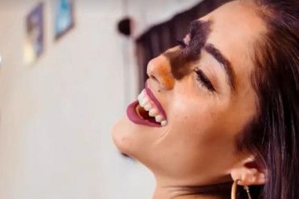 بالفيديو.. فتاة تستغل وحمتها الغريبة لتصبح عارضة أزياء
