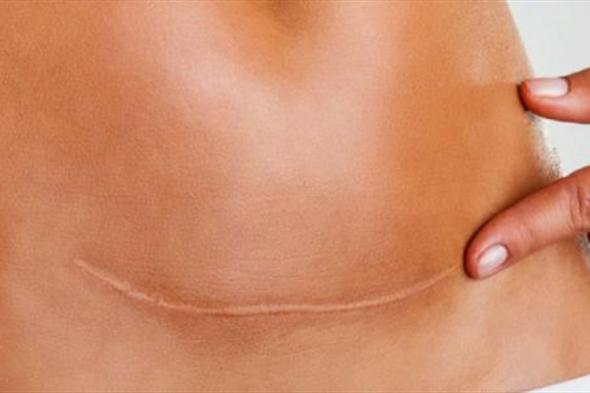 بيان لوزارة الصحة حول الولادات القيصرية.. هذا ما جاء فيه 
#لبنان
#lebanon24
 via @Lebanon24